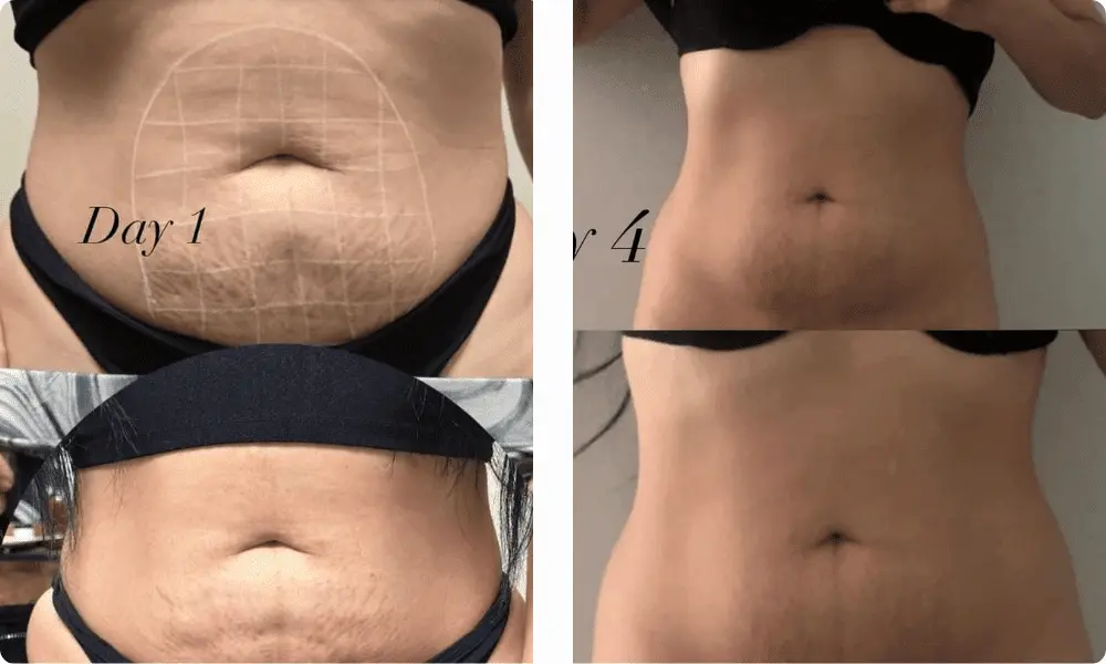 lipolysis-service-results